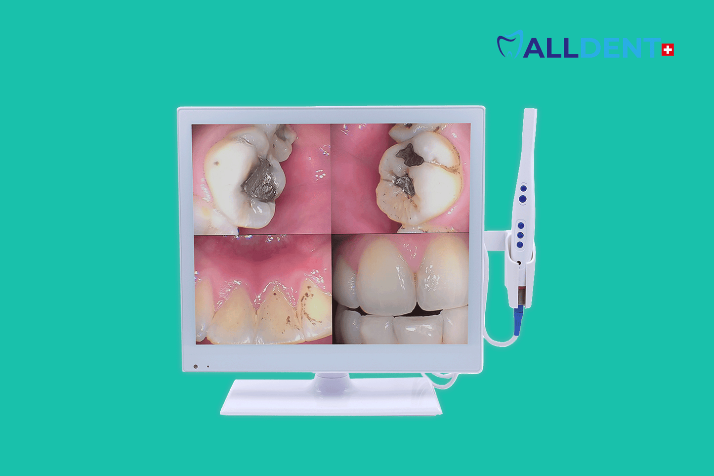 Alldent intraoral camera with 17" screen